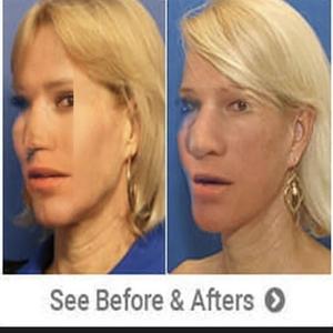 four five six (feat. 3c876 & ocelot)