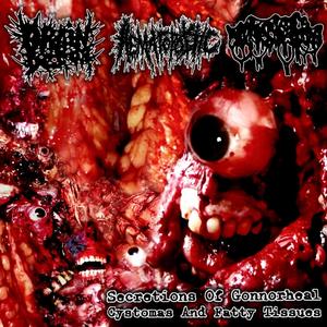 Blood Fountain