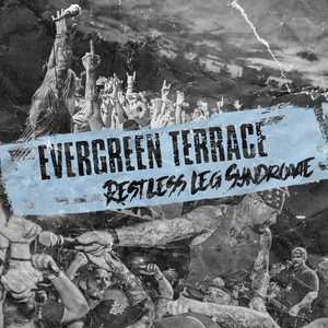 Restless Leg Syndrome