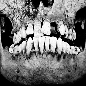 Who Put Bella In The Wych Elm?