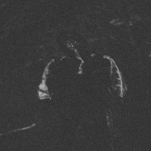 Километры как метры