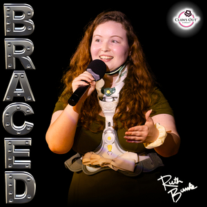 EDS (Ehlers Danlos Syndrome)