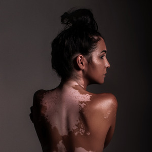 Redescobrir (Acústico)