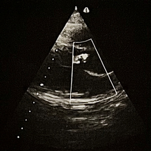 la brisa de tu ausencia