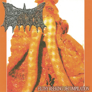 Gastrojejunostomy Part 2