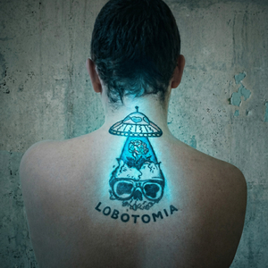 Lobotomia