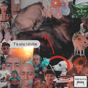 Calvitie