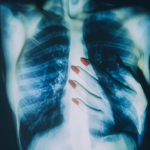 [Trap]泪痣-SASIOVERLXRD Type Beat