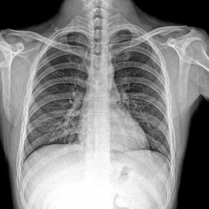 信号衰弱，感觉良好（demo）