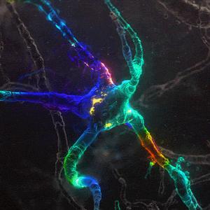 İçimde Her Şey Var