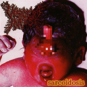 Hormona Adrenocorticotropico Purulenta