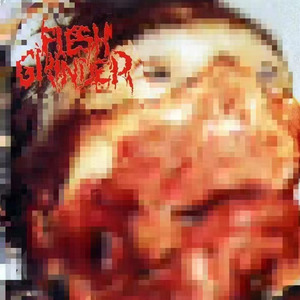 Chronic Mucocutaneous Candidiasis