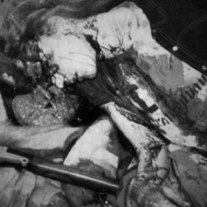 Fvck Life (Freestyle)