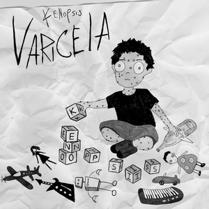 Varicela