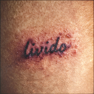 Livido