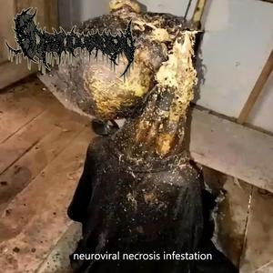 Fluoxetine Sertraline Escitalopram Amitriptyline