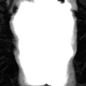 BULLDYKE (feat. MILÁN)