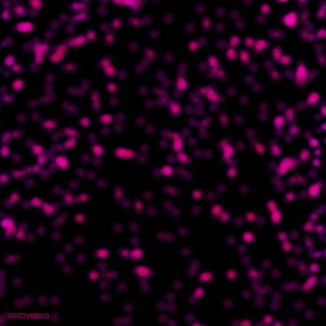 Quantum Entanglement