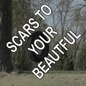Scars To Your Beautiful - Tribute to Alessia Cara