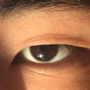 TRA$H-咽喉炎很疼（C2eD remix）