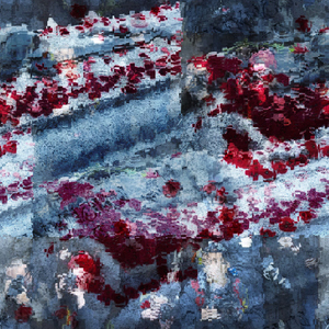 Dilatation And Curettage