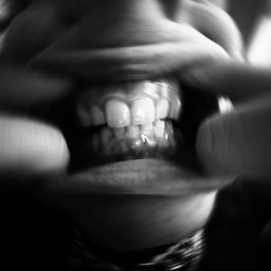 GUM DECAY