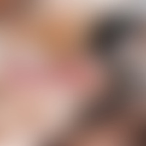 Bipolar Dream [Kid Loco Hip Hop Mix]