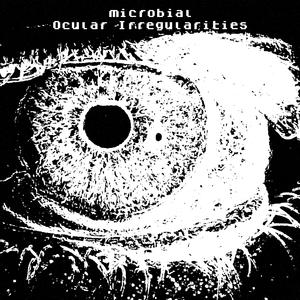 Ocular Irregularities