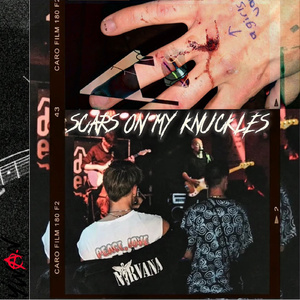 SCARS ON MY KNUCKLES