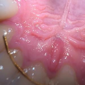 living, breathing, speeding, camera (20,000 eye verification ambient ver)