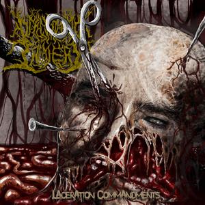 Laceration Commandments