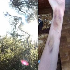 i'd rather take pills