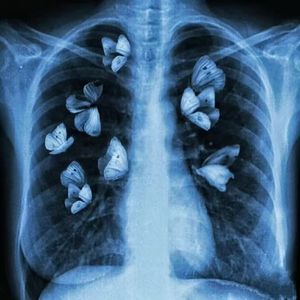 【FREE】孤独的钢琴 plugg&Ambient type beat UDG小子