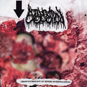 AVULSED MAXOFALLACIAL TISSUE