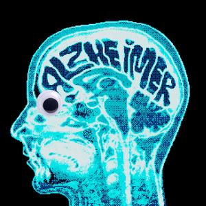 Alzheimer