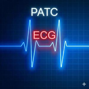 ECG