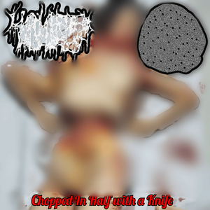 Intestinal Parasites Devouring the Bloated Stomach