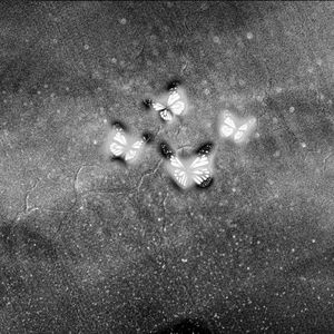 好了伤疤忘了疼