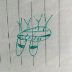 Schizophrenia Sentimentalist
