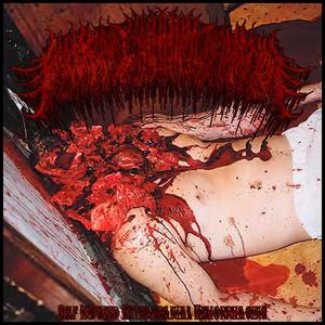 Self Induced Extracranial Hemorrhaging