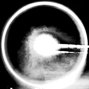 An Gléigealán Duibheacúil