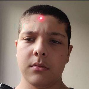 Queimaduras De Terceiro Grau Machucam Para Um Caralho !!!