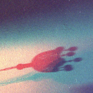 Bana bi'son lazım (Demo)