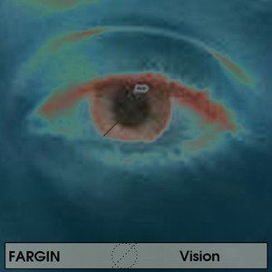 Vision