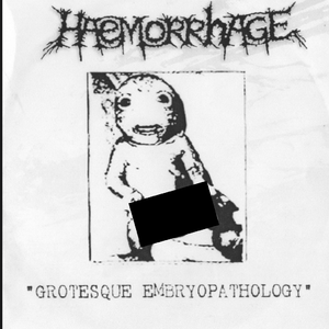 Uncontrollable Proliferation Of Neoplasm