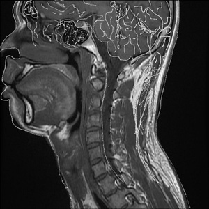 スケープゴート