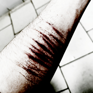 Одинокие Вены