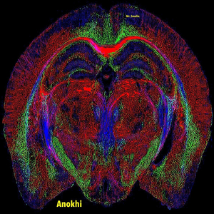 Anokhi