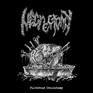 Pulverous Craniotomy