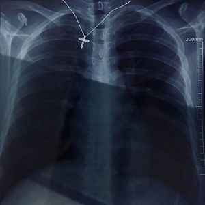 钥匙（C1oudson remix）